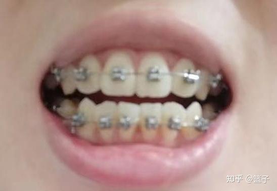 成人牙齿雕刻视频教学下载,视频教学下载指南