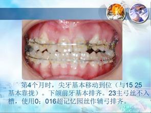 成人牙齿雕刻视频教学下载,视频教学下载指南